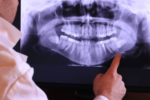 Best Dentist for Tooth Abscess  in Telford, PA