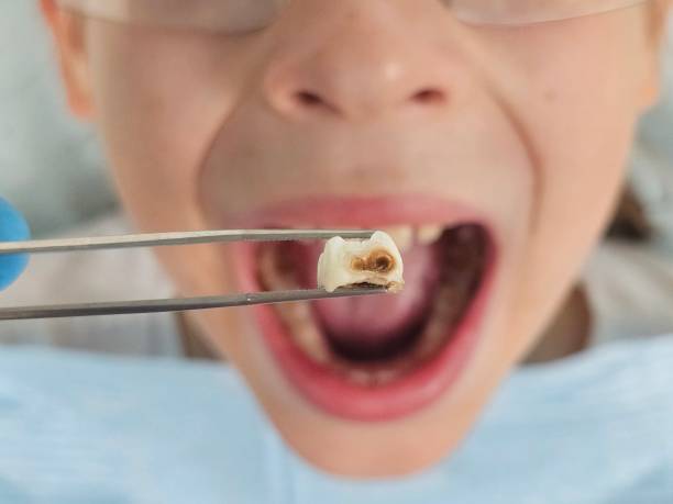 Best Tooth Infection Emergency Dentist  in Telford, PA